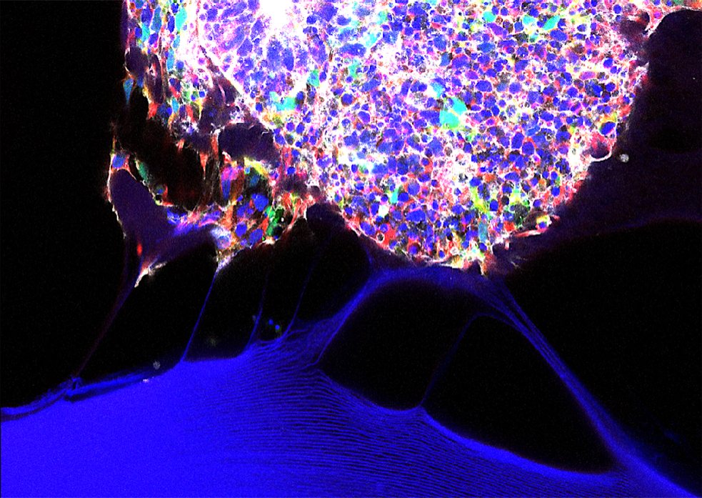 Organoide di cervello (umani) sviluppati nel laboratorio di Nicola Elvassore.