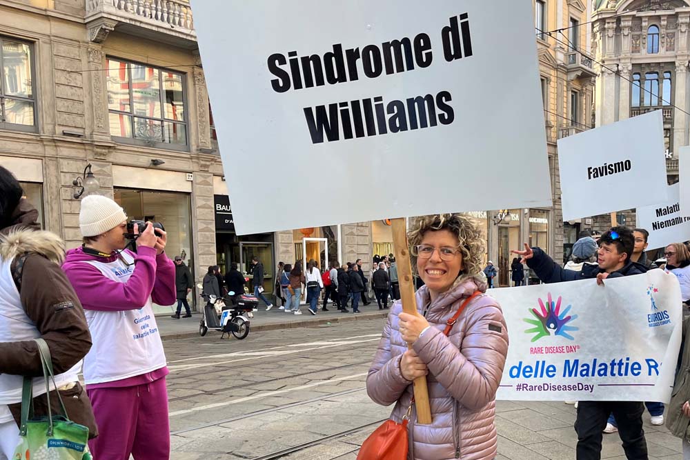 Elisa con la sindrome di Williams